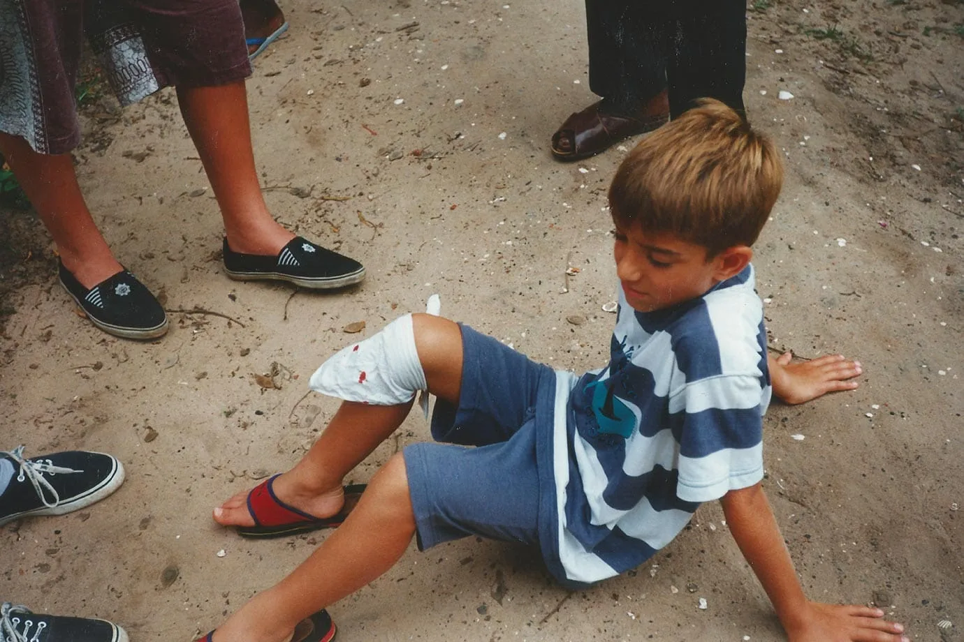 Crocodile bite